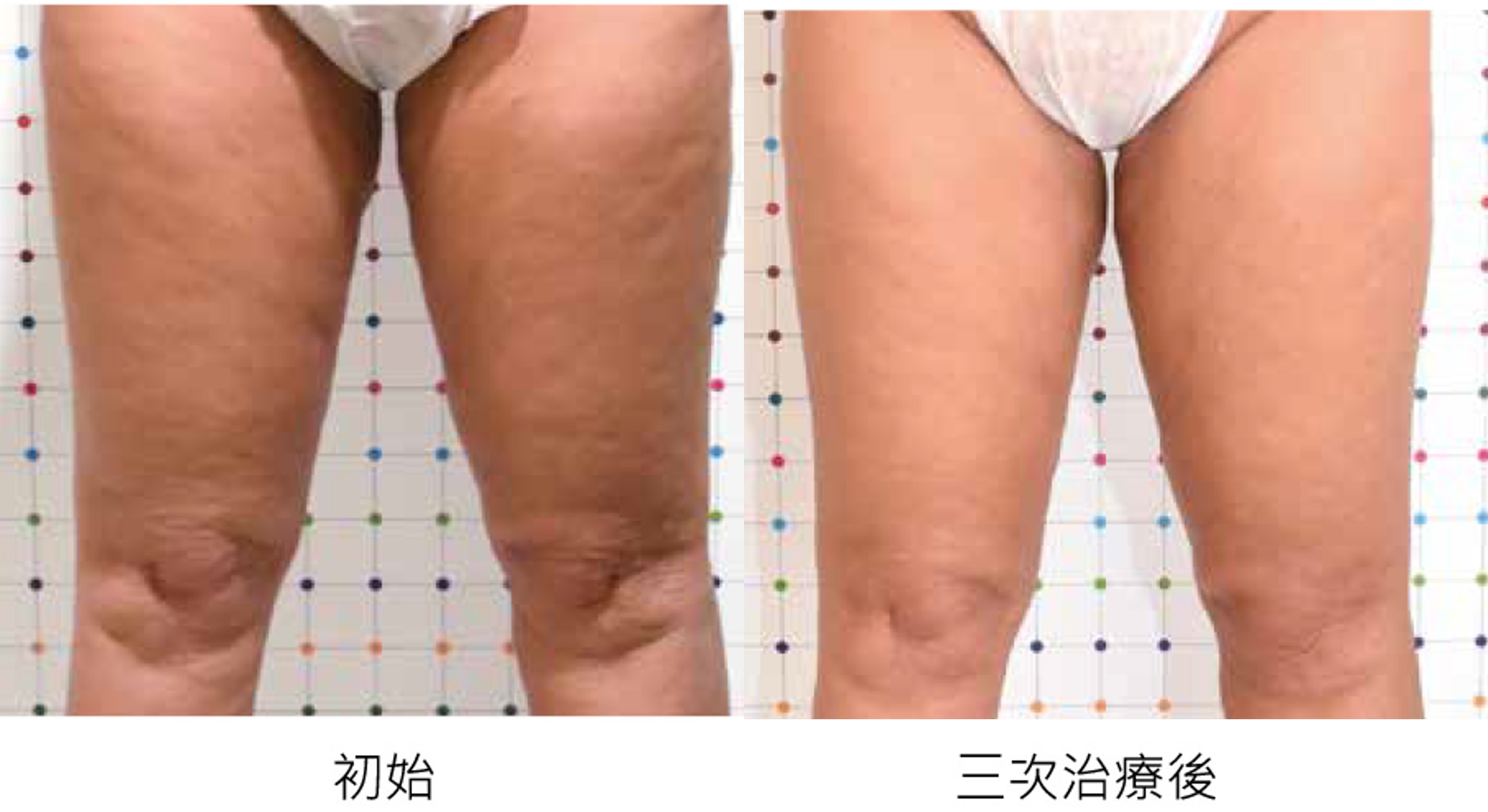 腿